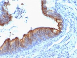 Mouse anti-Cytokeratin 8, Clone: KRT8/899, Novus Biologicals 0.2mg; Unlabeled:Antibodies,